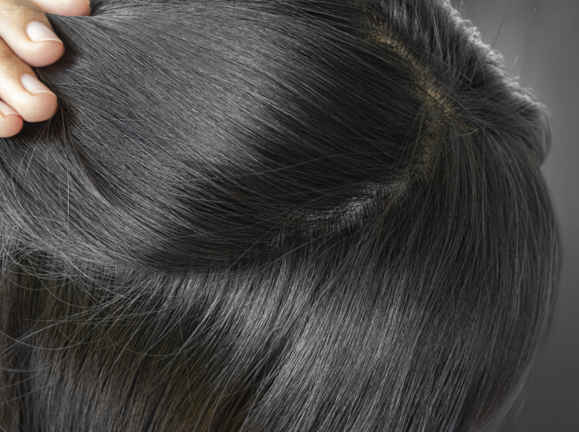hair loss dermatologist washington dc